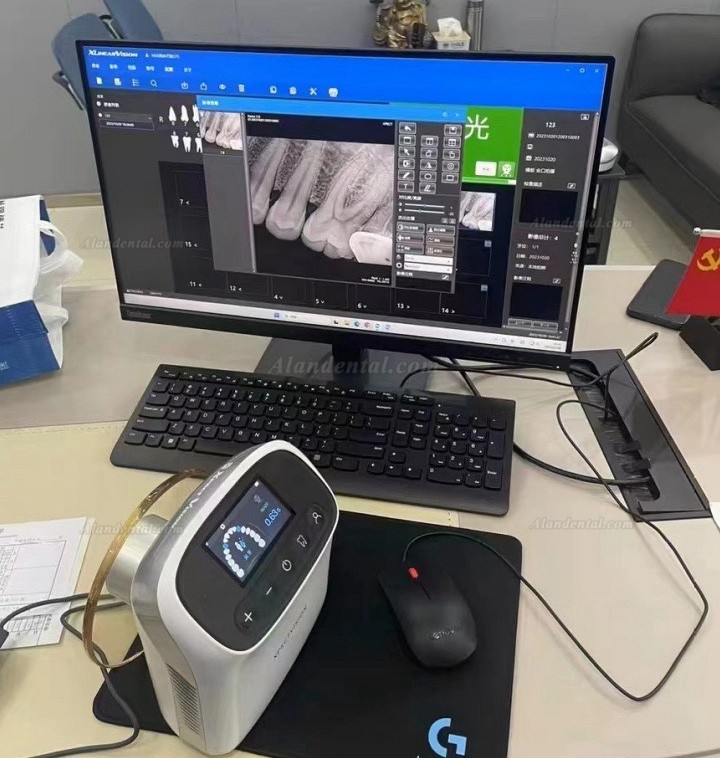 Dental Portable Dental X-Ray Machine Handheld High Frequency X Ray Unit XVbeam2000